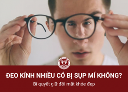 Đeo kính nhiều có bị sụp mí không? Bí quyết giữ đôi mắt khỏe đẹp